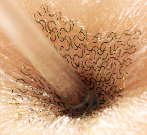 tattoo_compressed