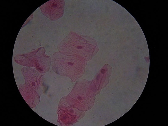 800px-Cheekcells_stained