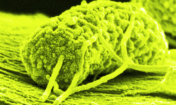 The microbe's wire-like tendrils are attached to a carbon filament to produce electricity. More than 100 of these 