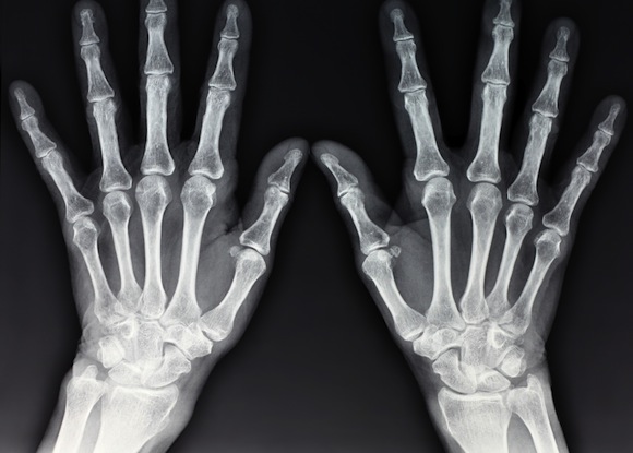 x-ray-hands