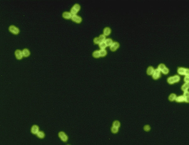 A digitally enhanced image of Streptococcus pneumoniae in spinal fluid. Image credit: CDC/Dr. M.S. Mitchell.