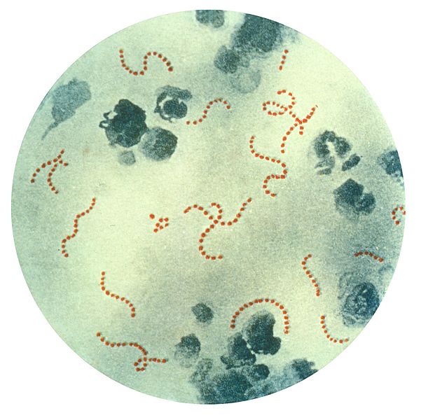 A 900 times-magnified image of Streptococcus pyogenes bacteria, extracted from pus. Image credit: CDC.