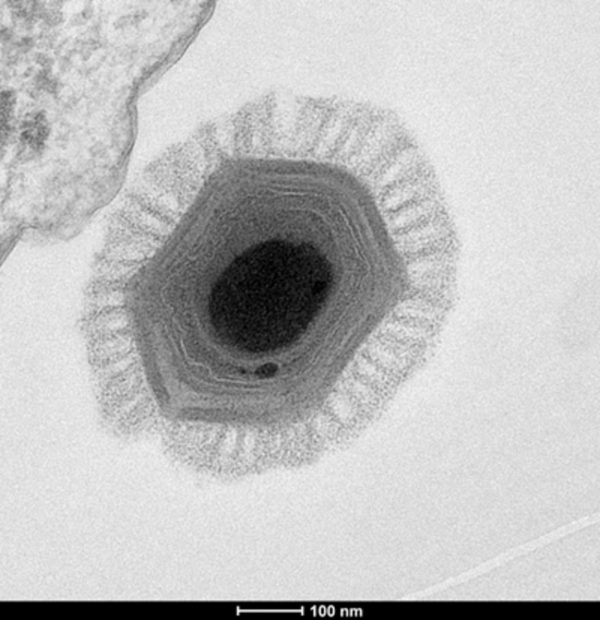 Megavirus has over a thousand genes, Pandoravirus has even more. Image via Chantal Abergel.