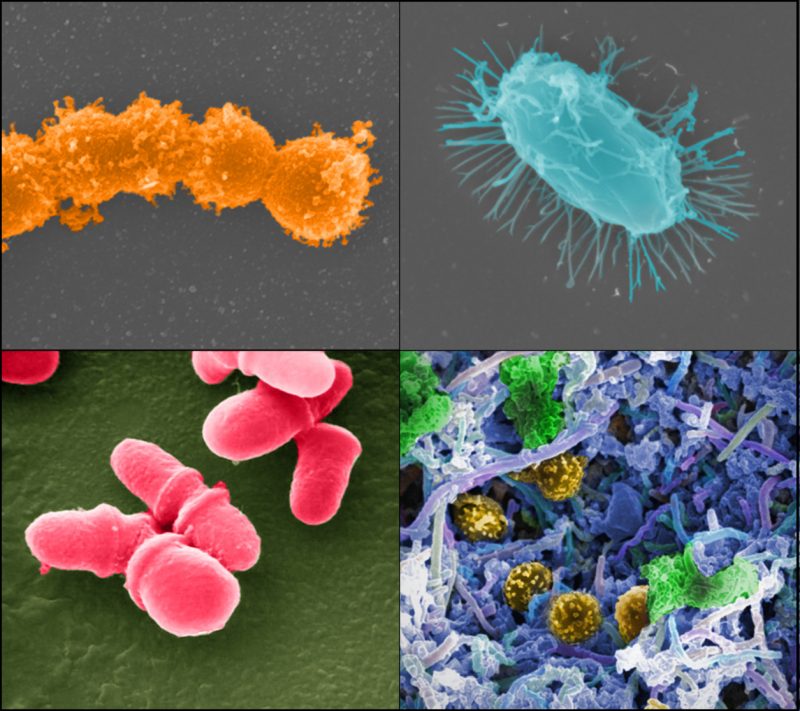 Examples of the microbes associated with healthy human beings. Image via Jonathan Bailey, NHGRI