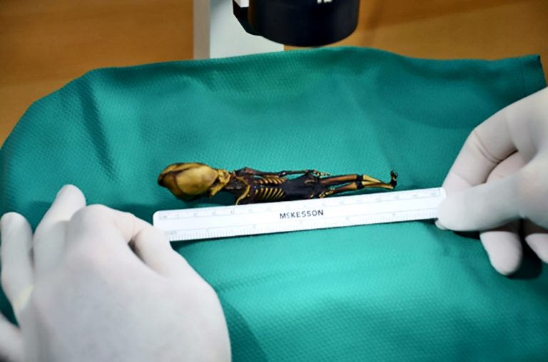 Mysterious skeleton is human, not alien | Human World | EarthSky