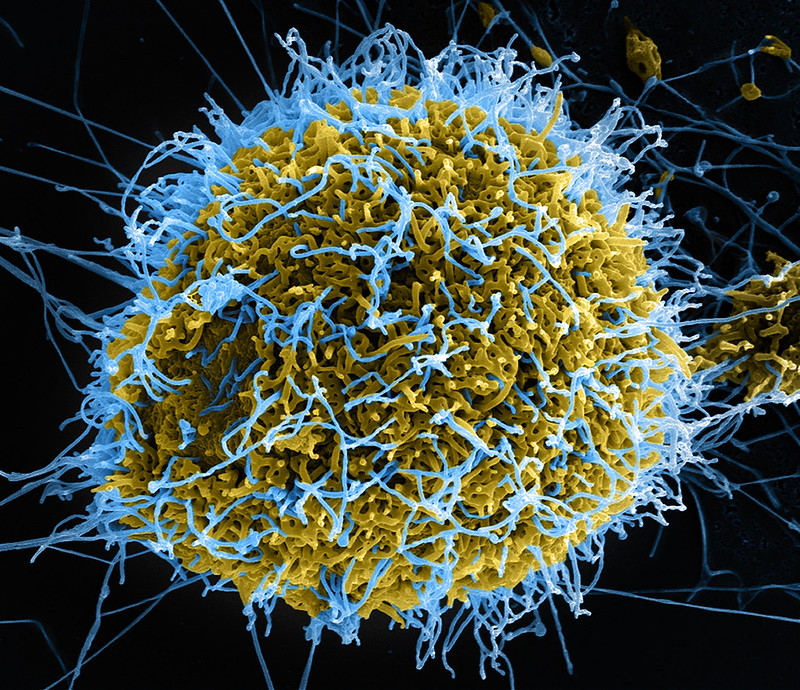 Spongy yellow ball covered in bright blue filaments.