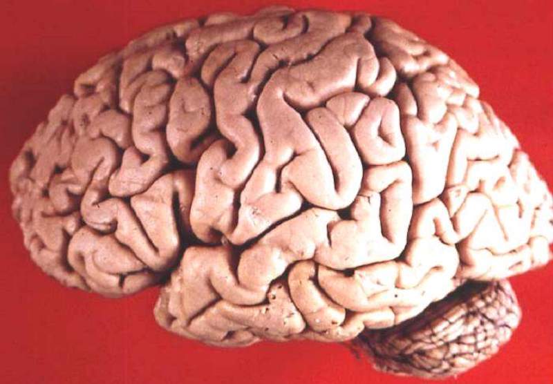 A brain: Irregular, hemispherical, shiny pink mass with many wriggly small folds on its surface.