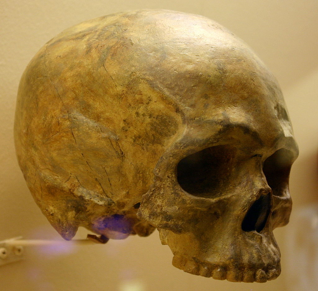 An old, brownish human skull with the lower jaw missing.