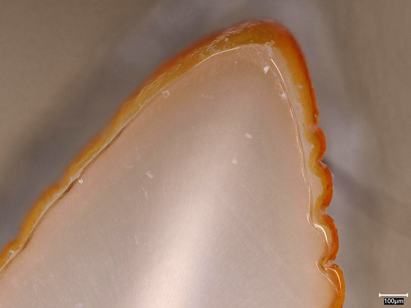 A tooth with orange stains along its edges
