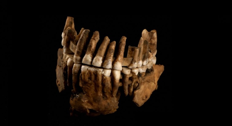 Dark brown jaw bones with stained whitish teeth on a black background.